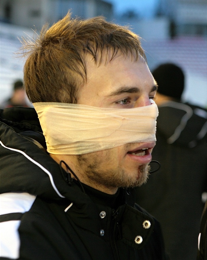 Zraněný Jan Štohanzl vytrval do konce zápasu