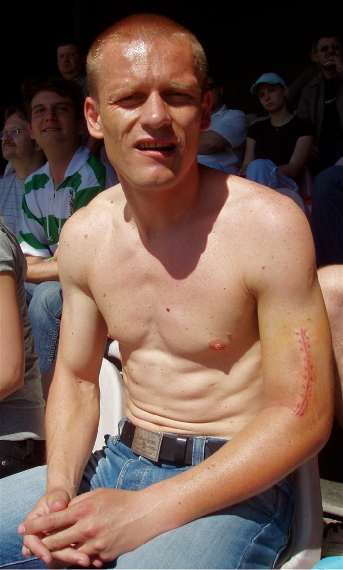 Dalibor Slezák v hledišti stadionu Viktorie Žižkov i s jizvou na ruce.